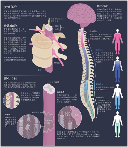 世界脊髓损伤领域取得重大突破，重塑康复希望之光